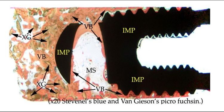 Journal of Dentistry and Oral Implants - Histomorphometric